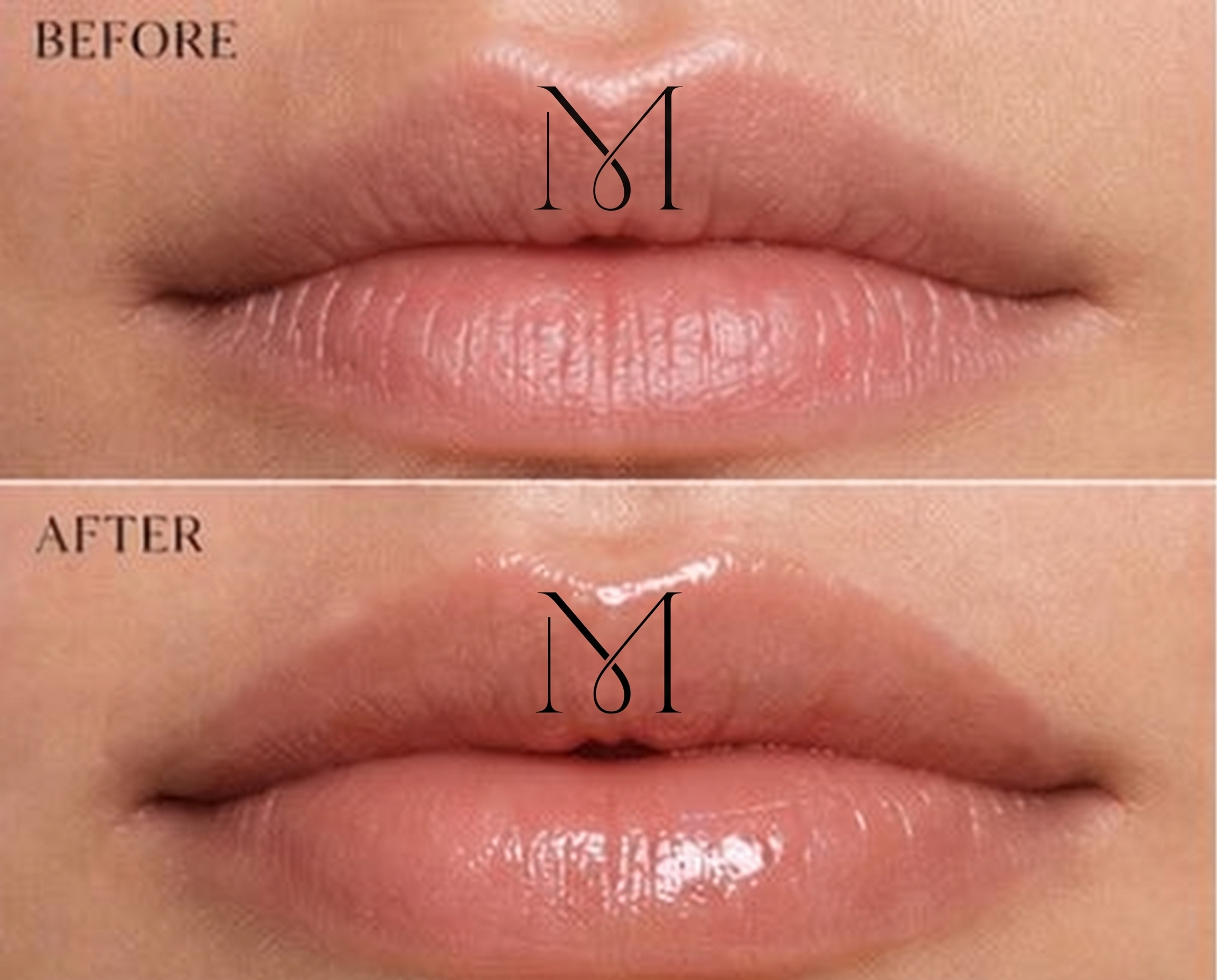 Luxury Lip Scrub — 04